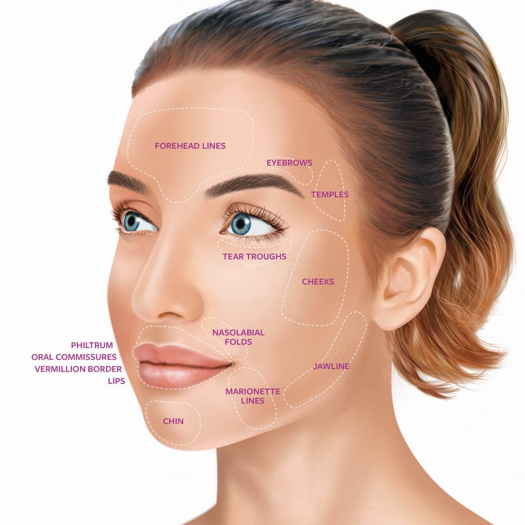 Dermal Fillers – Hannah Aesthetic Clinic